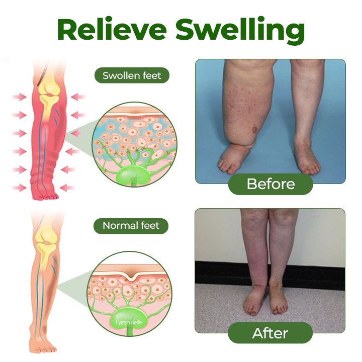Tiworld®Professional Leg Circulation Cream