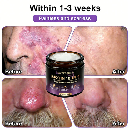 Made and Shipped from USA ✨SEAGRIL® Biotin 10-in-1 Skin Restoration Cream 🍀