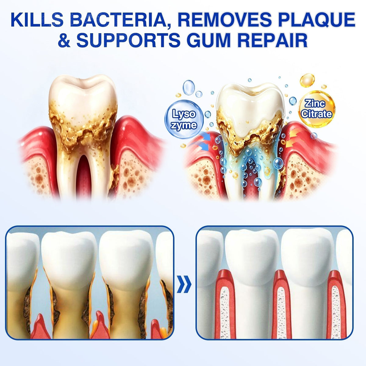 👨‍⚕️🦷🛡️Tiworld ® Gum health Periodontal Repair Gel