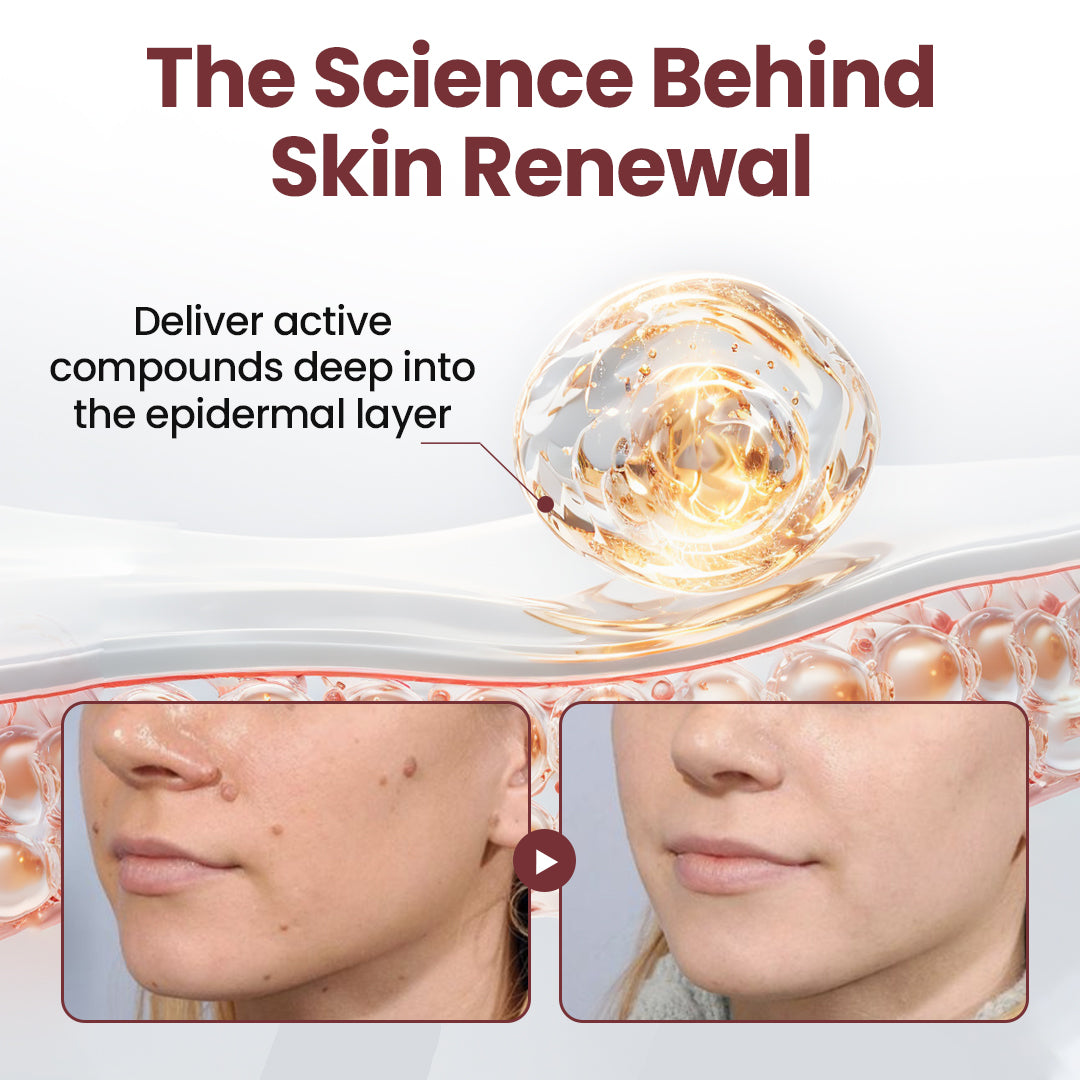 Tiworld KeraErase Dual-Action Renewal Cream | Smooth & Renew Skin Effortlessly