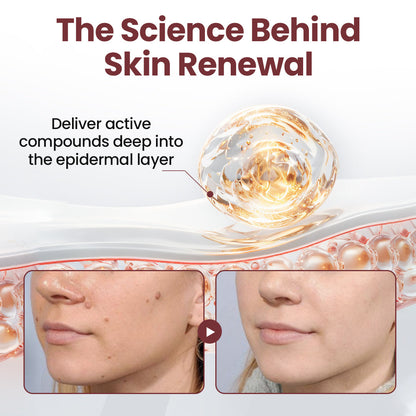 Tiworld KeraErase Dual-Action Renewal Cream | Smooth & Renew Skin Effortlessly