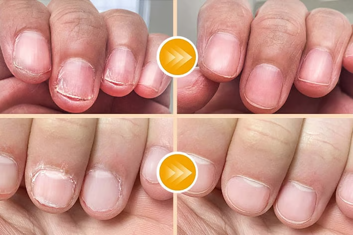 💐50% OFF ! Touch-Free Electric Nail Clipper: Safe, Fast & Gentle for All Ages!
