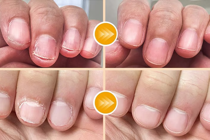 💐50% OFF ! Touch-Free Electric Nail Clipper: Safe, Fast & Gentle for All Ages!