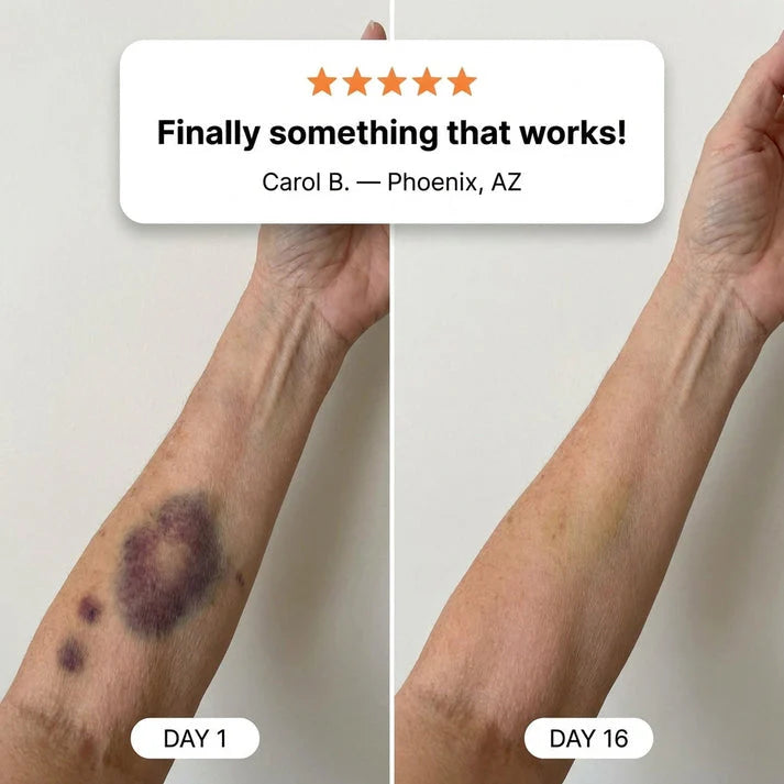SEAGRIL® Bruise Repair & Skin-Strengthening Cream
