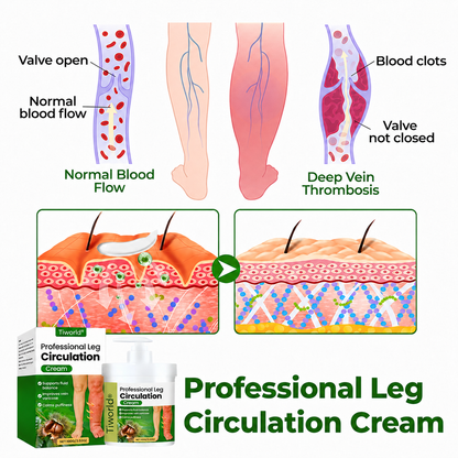 Tiworld®Professional Leg Circulation Cream